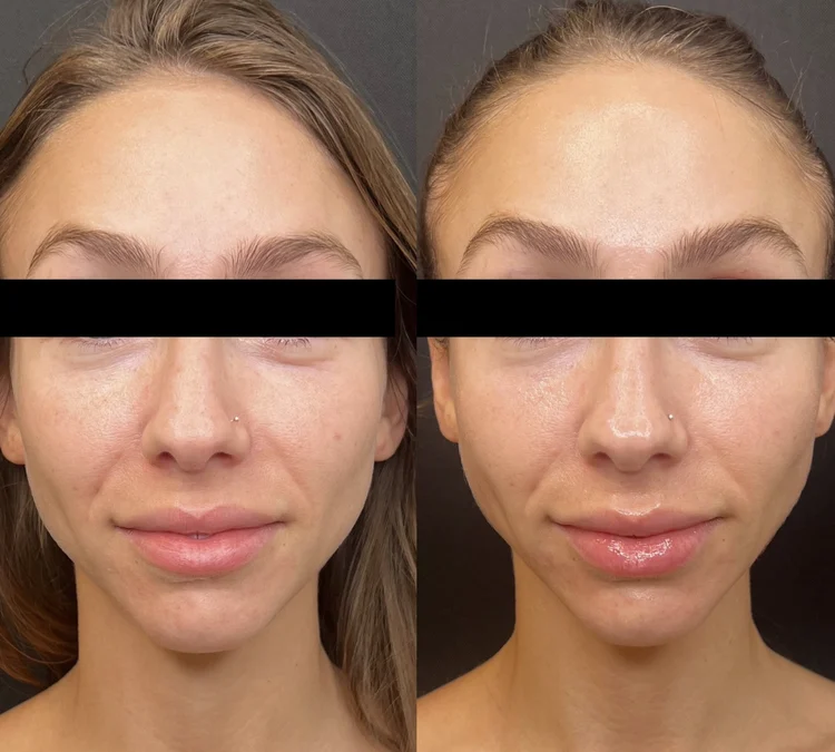 Experience the Magic: A Personalized Approach to Skincare