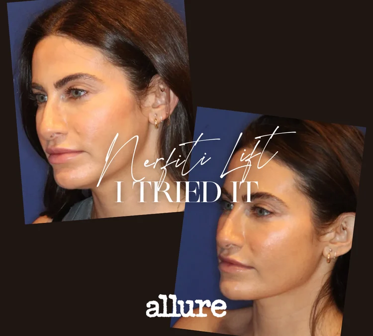 I Tried the “Nefertiti Lift” to Define My Jawline
