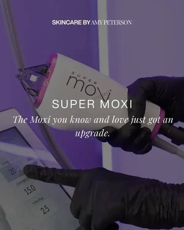 Super MOXI laser handpiece at Skincare by Amy Peterson